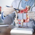 Doctor pointing at anatomical model of the colon
