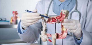 Doctor pointing at anatomical model of the colon