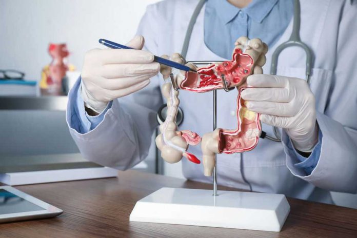 1999071686 Doctor pointing at anatomical model of the colon