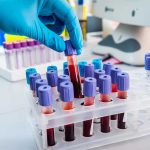 Rare Screwworm Pest Detected in Texas Livestock Gloved hand handling blood samples in a laboratory.
