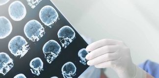 Doctor holding brain MRI scans