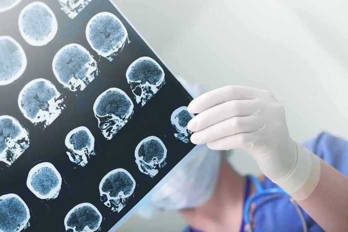 shutterstock_336642827 Doctor holding brain MRI scans